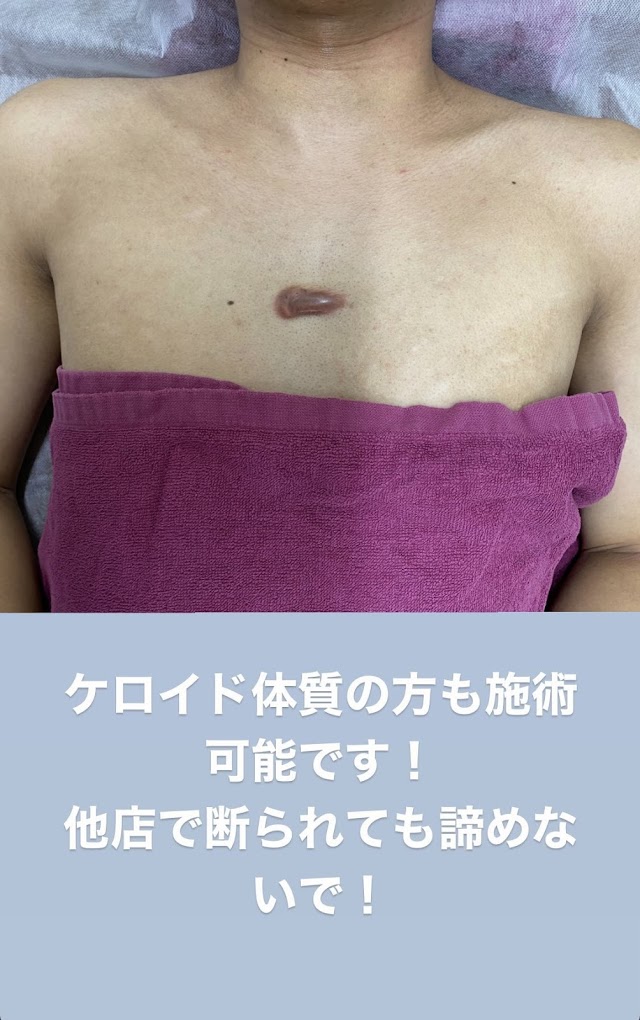 脱毛サロン エピラージュ 新宿店（写真3）