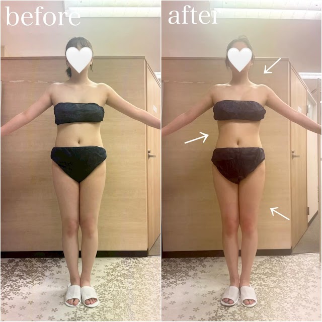大阪梅田 痩身ダイエット専門店 esthetic salon R（写真2）